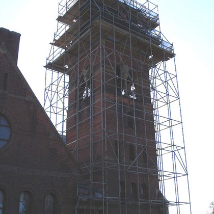 Scaffold Engineering For Restorations